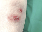 Small derm 351 rycina 1 opt