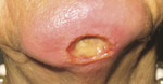 Small derm 351 rycina 2 opt