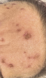 Small derm 351 rycina 3 opt