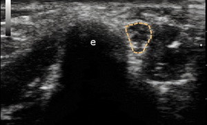 Small 3 opt