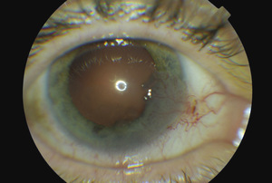 Small ryc 1 opt