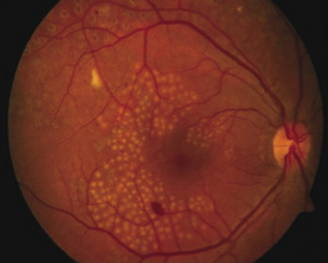 Small ryc 3 opt