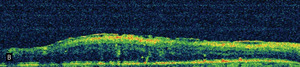 Small 8806