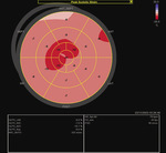 Small 3 opt