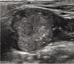 Small tarczyca ryc2 opt