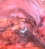 Small ryc. 3 opt