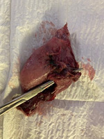 Small ryc. 4 opt