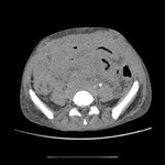 Small ryc. 5 opt
