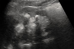 Small 3 opt