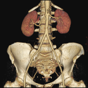 Small ryc 5 opt
