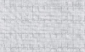 Small ryc opt