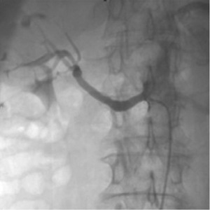 Small ryc 1b fmt