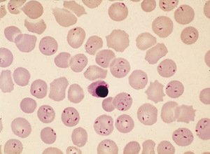 Small akinosoglou 1 opt