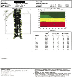Small o2(ryc.6) opt