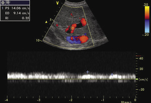 Small ryc 3 c opt
