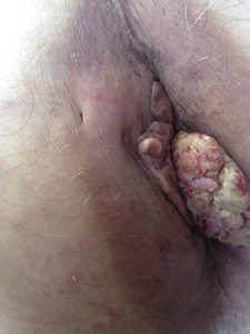 Small ryc 04 opt