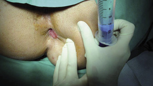 Small ryc 08 opt
