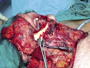 Small 02 zdj%c3%aacie opt