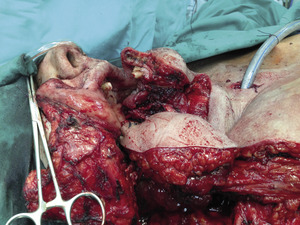 Small 04 zdj%c3%aacie opt