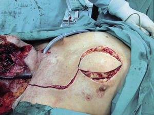Small 05 zdj%c3%aacie opt