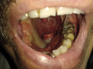 Small 06 zdj%c3%aacie opt