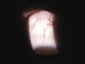 Small ryc 1 opt