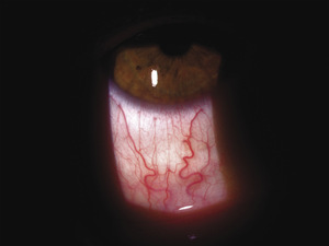 Small ryc 2 opt