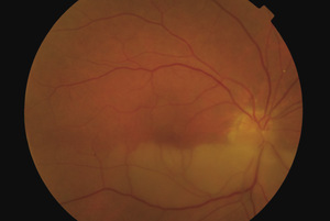 Small ryc 4 opt