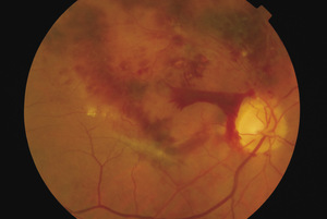 Small ryc 5 opt