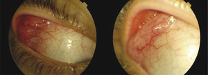 Small ryc 6 opt