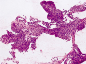 Small 2.ptc bac kat opt