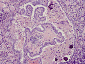 Small 5 ptc 40x opt