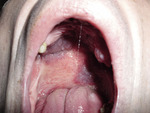 Small ryc 02 opt