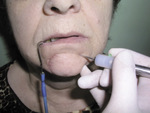 Small image004 opt