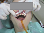 Small 04 opt