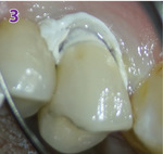 Small 8879