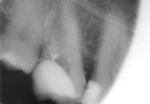 Small 01 opt