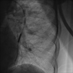 Small image002 opt