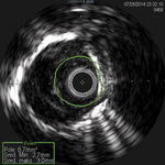 Small image003 opt