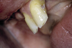 Small fot 2 opt