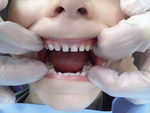 Small ryc 1 opt