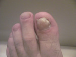 Small 5 opt
