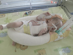 Small maks po operacji opt