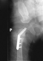 Small 03 opt