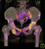 Small 3 med trib przerzuty r opt
