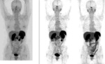 Small 5 med trib efekt lecze opt