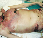 Small 5399