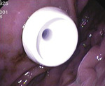 Small rycina 3 300 opt