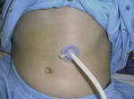 Small rycina 1 300 opt