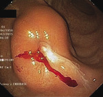 Small rycina 6 300 opt